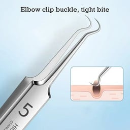 BLACKHEAD REMOVER ACNE TOOL