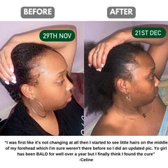 Batana Natural Hair Growth Oil