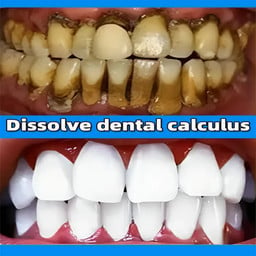 Dental Calculus Remover Toothpas