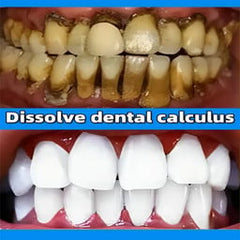 Dental Calculus Remover Toothpas